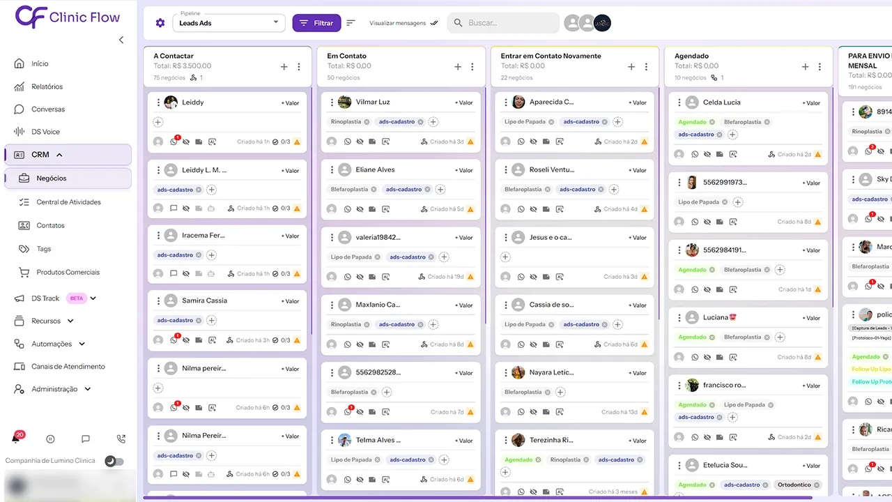 Screenshot do CRM Zayit — Pipeline de leads com etapas: a contactar, contactado, agendado, compareceu, vendido